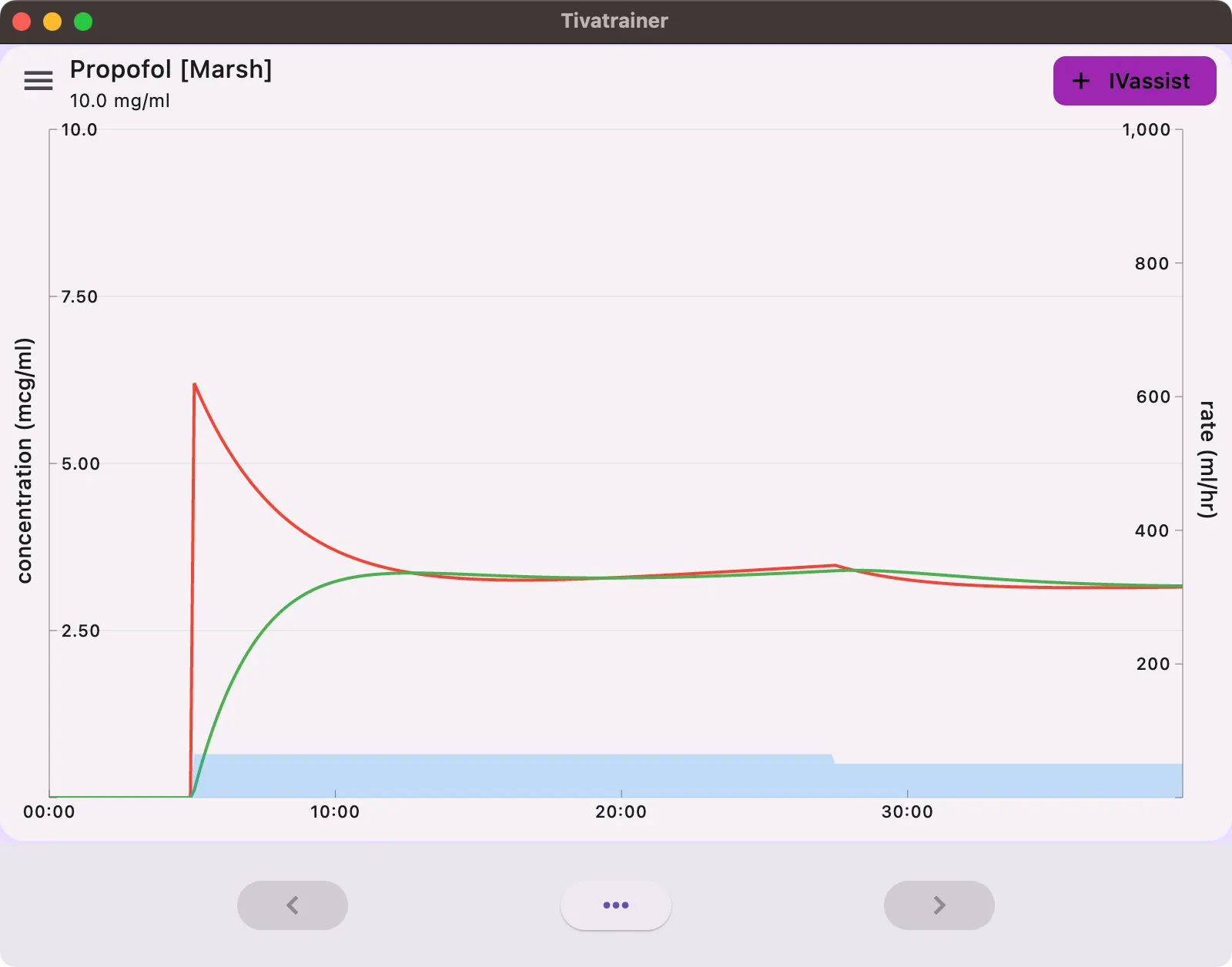 IVassist simulation example